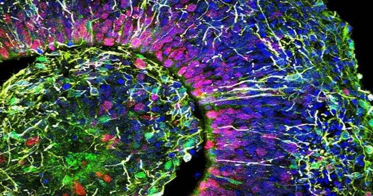 Hình ảnh lát cắt cơ quan tế bào não người (ảnh Đại học California San Diego)