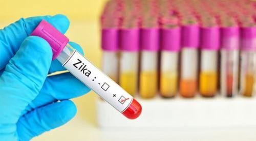 TP HCM ghi nhận 3 trường hợp nhiễm virus Zika.