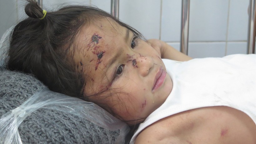 Bé Nguyễn Trần Sa Ny (5 tuổi) thoát chết trong vụ sạt lở núi nhưng trầy xước khắp người. Ảnh: Xuân Hiển
