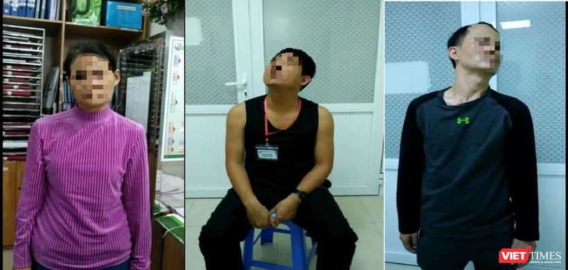 Hình ảnh một số bệnh nhân loạn trương lực cơ cổ khám và điều trị tại khoa Nội Hồi sức Thần kinh - Bệnh viện Hữu nghị Việt Đức (Ảnh: BVCC) 