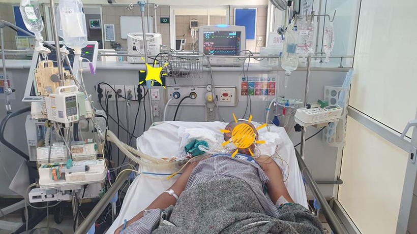 Bệnh nhân Đỗ Văn Ch. (46 tuổi, ở Tĩnh Gia, Thanh Hóa) nhập viện vào BV Bạch Mai trong tình trạng đã ngừng tim, hiện vẫn hôn mê sâu (Ảnh: BVCC) 
