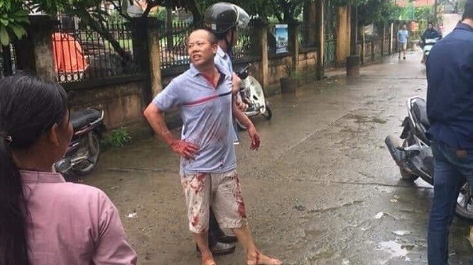 Kẻ gây án Nguyễn Văn Đông bị lực lượng chức năng bắt giữ.