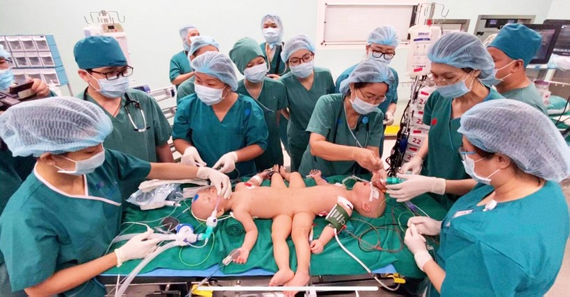 Gần 100 y, bác sĩ đang tiến hành phẫu thuật tách rời cặp song sinh Trúc Nhi – Diệu Nhi (Ảnh: Bệnh viện Nhi đồng Thành phố - TP. Hồ Chí Minh)