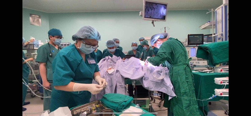 Bác sĩ phẫu thuật tách rời cặp song sinh dính liền (Ảnh: Bệnh viện Nhi đồng Thành phố - TP. Hồ Chí Minh) 