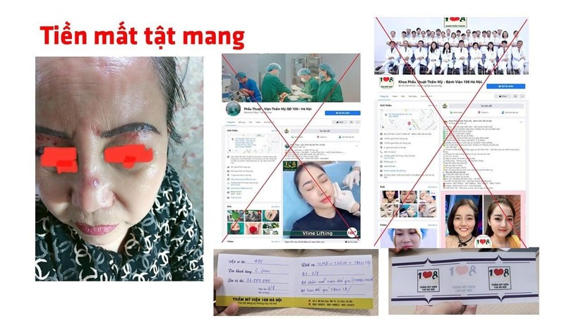 Trang facebook mạo danh Bệnh viện Trung ương Quân đội 108 khiến người dân "tiền mất, tật mang" (Ảnh - BVCC) 