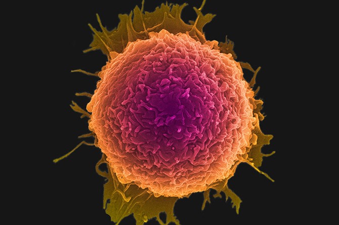 Đĩa nano có thể diệt các tế bào ung thư?